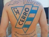 Tattoo - Tatuaje - tatuagem - Tatuaje de la Barra: Los Villeros • Club: Cerro